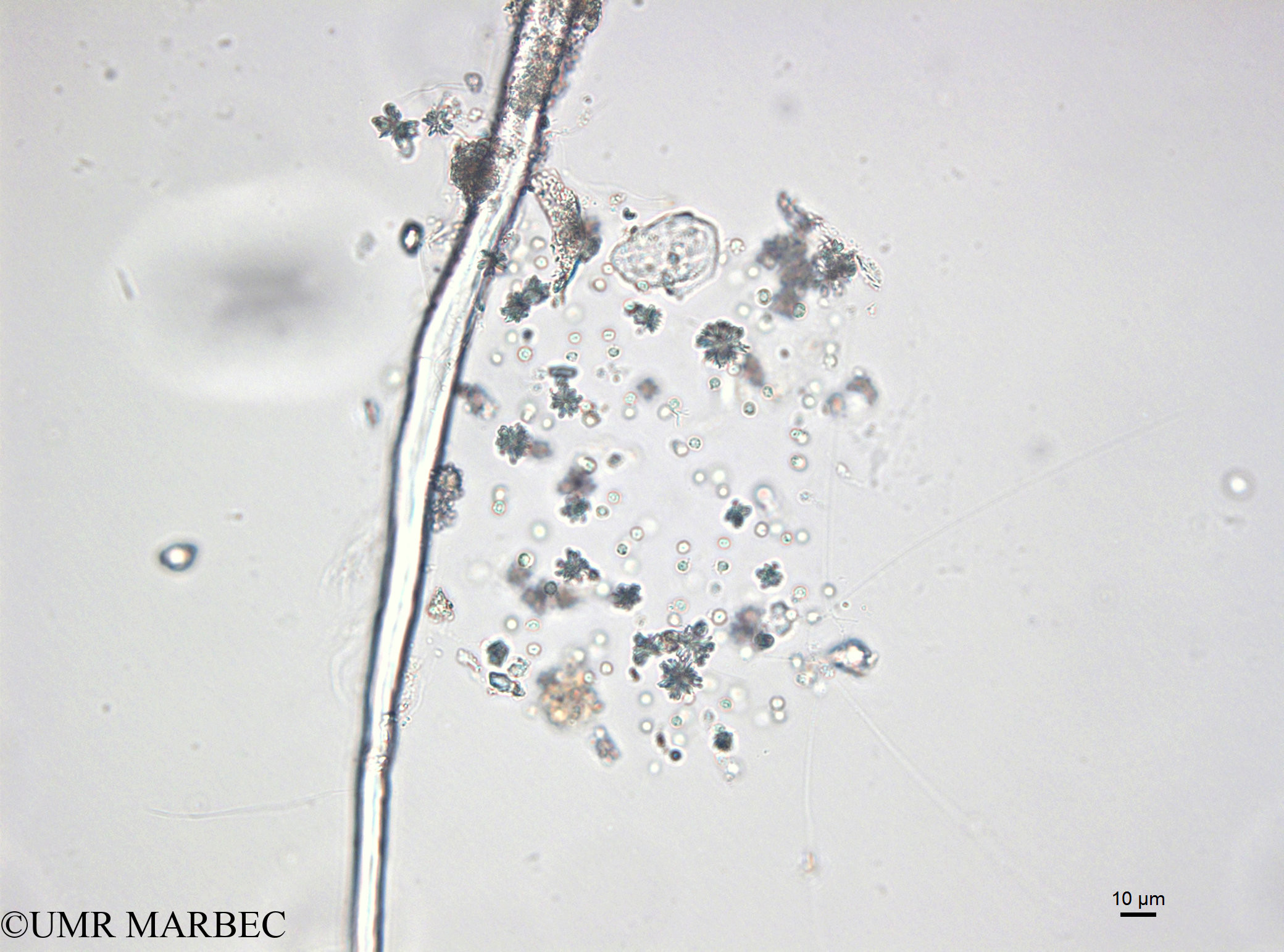 phyto/Bizerte/bizerte_bay/RISCO April 2014/Phaeocystis sp (Microflagellé 17 - Microflagellé spp en colonie141218_001_ovl -5)(copy).jpg